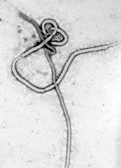 The Ebola virus.